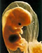 Feto de 2 meses.