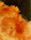 Placenta de 6&frac12; semanas (1 mes &frac12;).