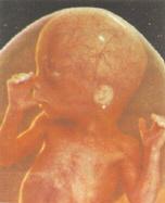 Feto de 18 semanas (4,5 meses).